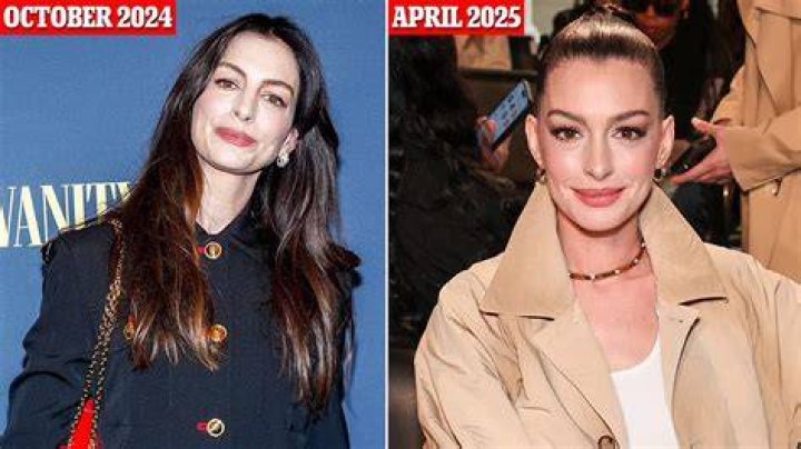 Anne Hathaway Plastic Surgery