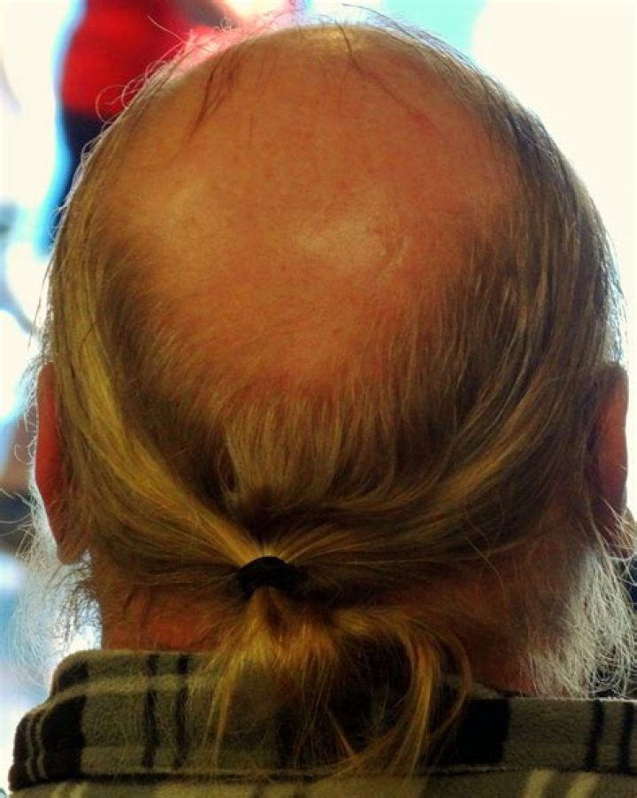 BALD GUY WITH PONYTAIL ! but why ?? Cool Stuff ! Pinterest Bald guy and Pet peeves