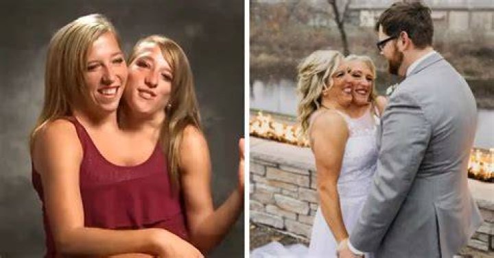 Conjoined Twin Abby Hensel's Husband Faces Paternity Suit