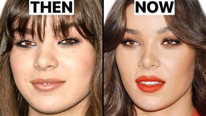 Did Hailee Steinfeld Undergo Nose Job Surgery? Did Hailee Steinfeld Undergo Nose Job Surgery?