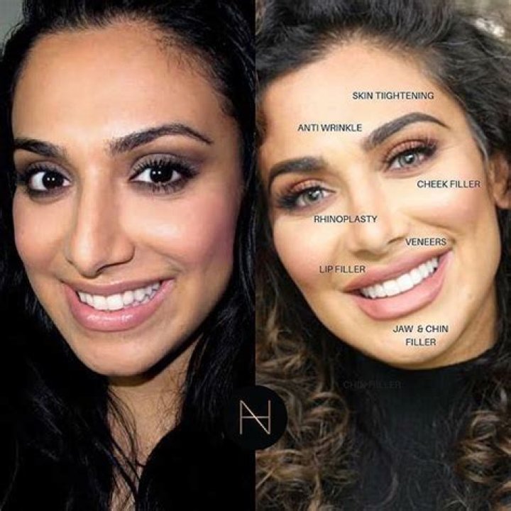 Did Huda Kattan Get Plastic Surgery? Huda Kattan Before and After. Did Huda Kattan Get Plastic Surgery? Huda Kattan Before and After.