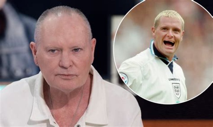Did Paul Gascoigne Undergo Plastic Surgery? Did Paul Gascoigne Undergo Plastic Surgery?