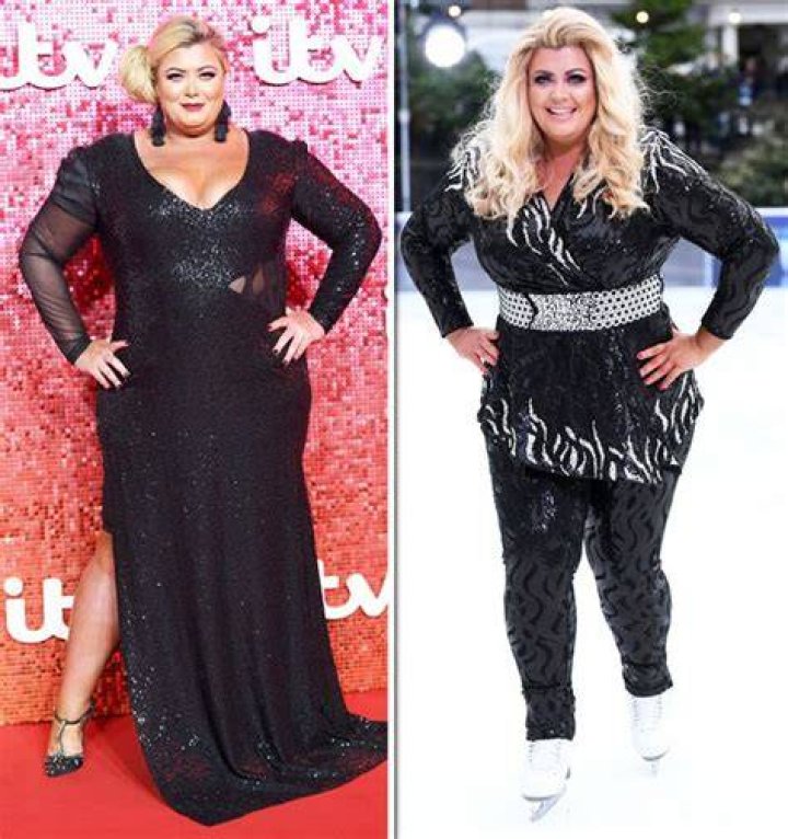 Gemma Collins Weight Loss Before and After, Who is Gemma Collins? Gemma Collins Weight Loss Before and After, Who is Gemma Collins?