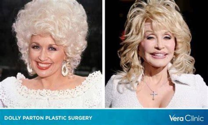 Has Dolly Parton Had Plastic Surgery? What Plastic Surgery Has Dolly Parton Had? Has Dolly Parton Had Plastic Surgery? What Plastic Surgery Has Dolly Parton Had?