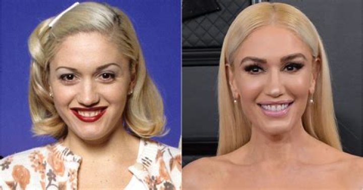Has Gwen Stefani Had Plastic Surgery? Who is Gwen Stefani? Has Gwen Stefani Had Plastic Surgery? Who is Gwen Stefani?