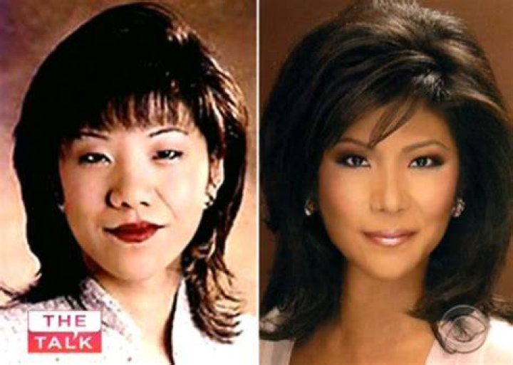 Julie Chen Had Plastic Surgery? Did Julie Had Plastic Surgery? Truth Revealed Julie Chen Had Plastic Surgery? Did Julie Had Plastic Surgery? Truth Revealed