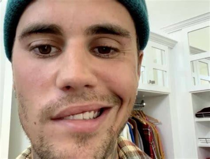 Justin Bieber Explains Rare Virus That Has Paralyzed Half of His Fa...