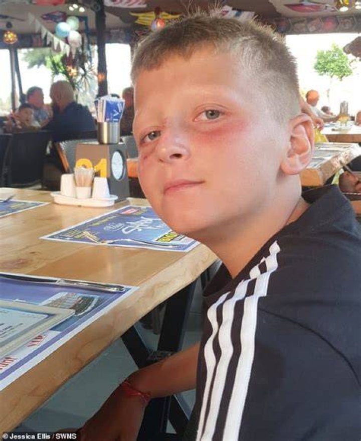 Kainen Ellis, 11, travelled abroad with his family to Turkey on July 1 and stayed at the three-star Eftalia Splash Resort in Antalya - his first holiday since the start of the Covid-19 pandemic