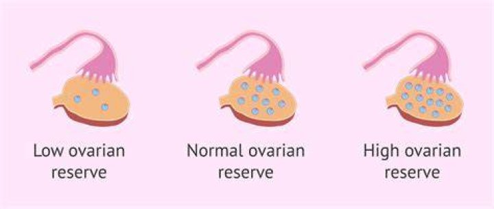 Low ovarian reserve: Amy's fertility doctor told her: 'We're not going to freeze your eggs if we don't need to' because of her age - but they ended up doing so as she had low ovarian reserve