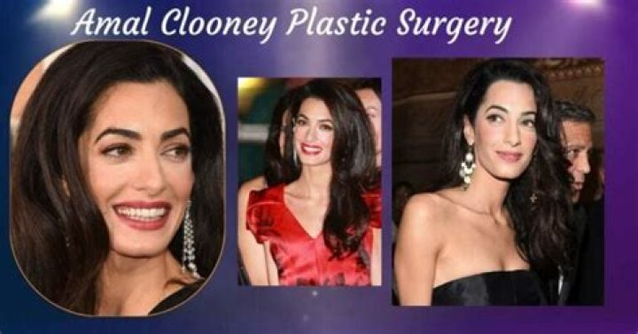 Plastic Is Perfect! Amal Clooney's Shocking New Face Is From Secret Surgery See Her