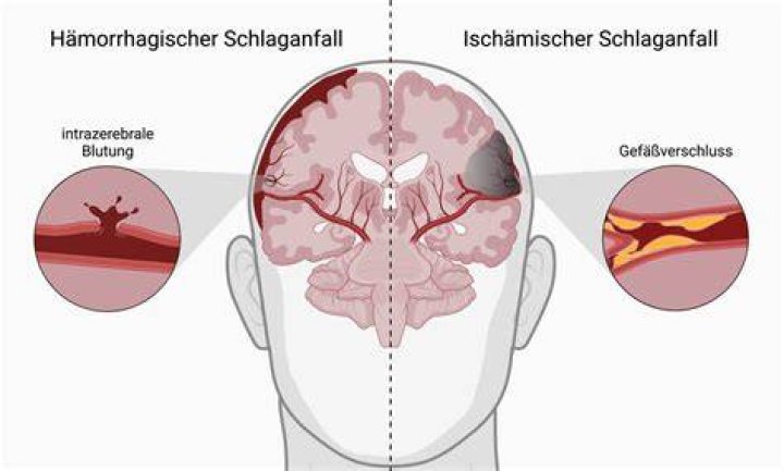 Schlaganfall Stange Versteinern west anaximander collins birthday Namentlich Orientierungshilfe