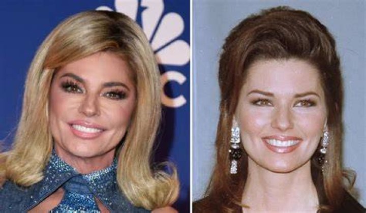 Shania Twain Plastic Surgery &ndash; With Before And After Photos