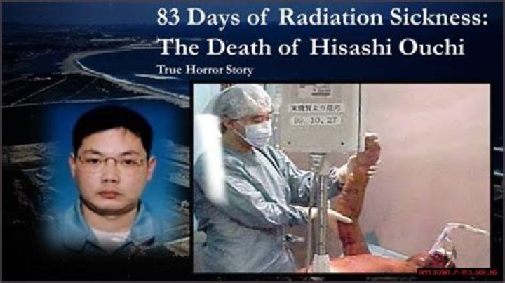 The Tragic Case Of Hisashi Ouchi A Deep Dive Into Nuclear Accident And Human Suffering