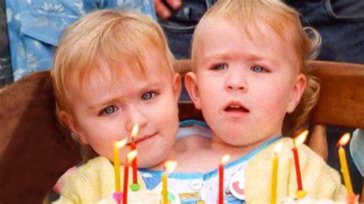 Two Heads, One Body Eilish Holton's Life After Seperating From Her Conjoined Twin Our Life