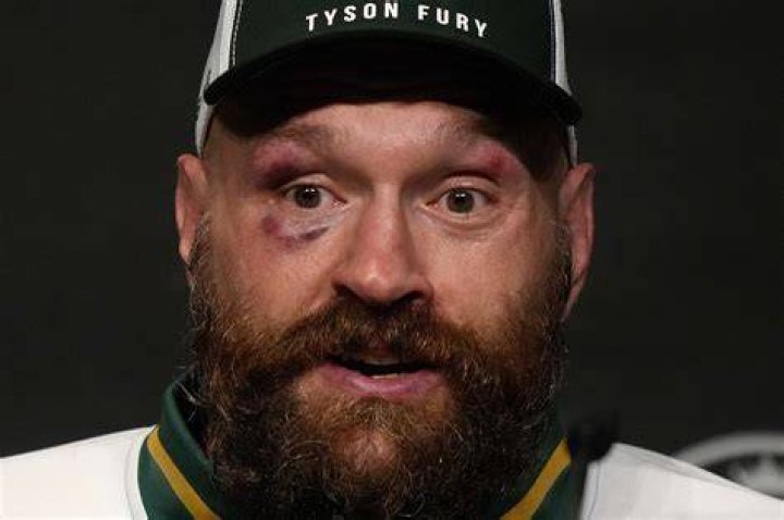  Tyson Fury says he is not looking to move away from the seaside town of Morecambe
