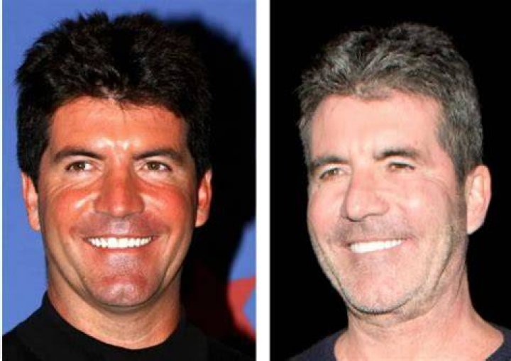 Understanding Simon Cowell's Son's Illness A Comprehensive Overview
