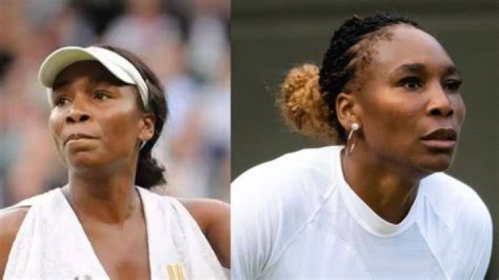 Unveiling The Truth: Did Venus Williams Have Plastic Surgery?