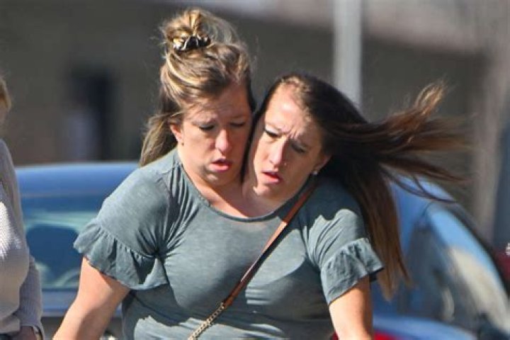 What conjoined twins Abby and Brittany have said about having a baby HELLO!