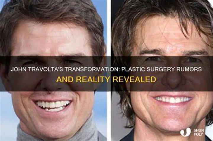 What Plastic Surgery Damaged John Rzeznik Face? What Plastic Surgery Damaged John Rzeznik Face?