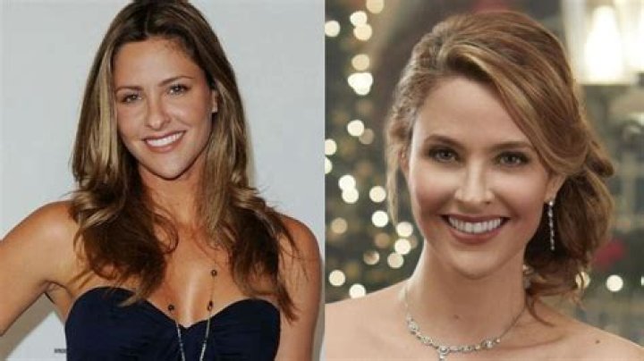 What Plastic Surgery Did Jill Wagner Undergo? What Plastic Surgery Did Jill Wagner Undergo?
