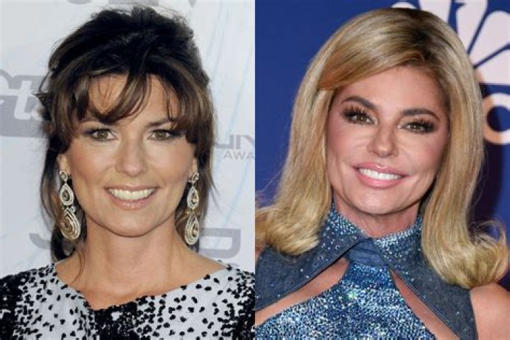 Why does Shania Twain Look So Puffy?