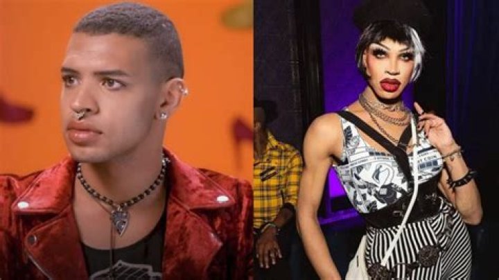 Yvie Oddly Before And After Plastic Surgery